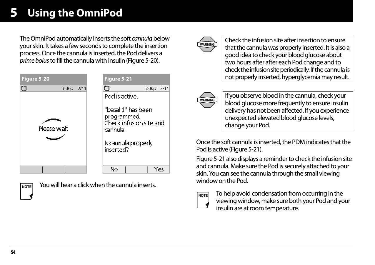 Using the OmniPod545The OmniPod automatically inserts the soft cannula below your skin. It takes a few seconds to complete the insertion process. Once the cannula is inserted, the Pod delivers a prime bolus to fill the cannula with insulin (Figure 5-20).Once the soft cannula is inserted, the PDM indicates that the Pod is active (Figure 5-21).Figure 5-21 also displays a reminder to check the infusion site and cannula. Make sure the Pod is securely attached to your skin. You can see the cannula through the small viewing window on the Pod.You will hear a click when the cannula inserts.Figure 5-20 Figure 5-21Check the infusion site after insertion to ensure that the cannula was properly inserted. It is also a good idea to check your blood glucose about two hours after after each Pod change and to check the infusion site periodically. If the cannula is not properly inserted, hyperglycemia may result.If you observe blood in the cannula, check your blood glucose more frequently to ensure insulin delivery has not been affected. If you experience unexpected elevated blood glucose levels, change your Pod.To help avoid condensation from occurring in the viewing window, make sure both your Pod and your insulin are at room temperature.