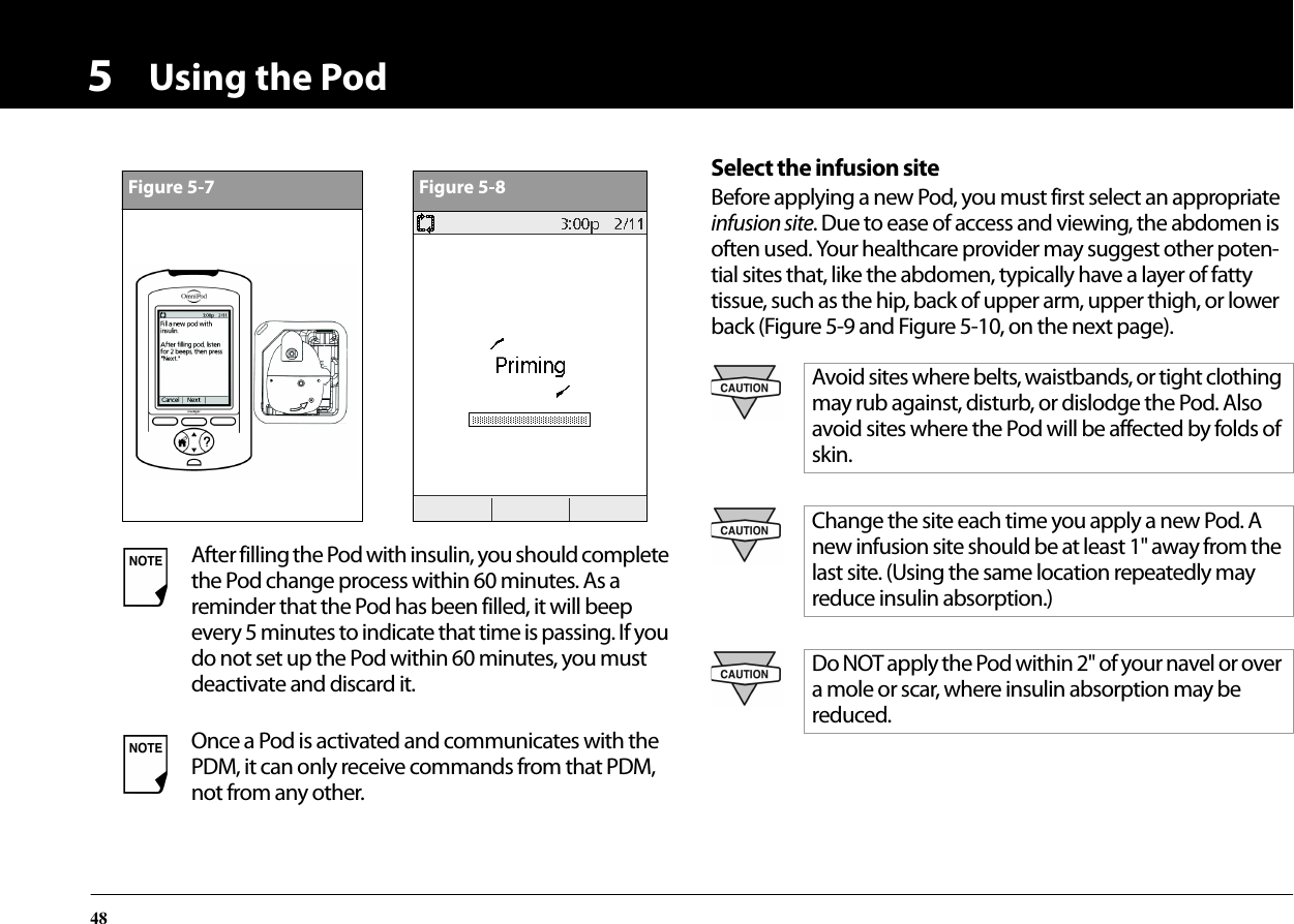 Using the Pod485 Select the infusion siteBefore applying a new Pod, you must first select an appropriate infusion site. Due to ease of access and viewing, the abdomen is often used. Your healthcare provider may suggest other poten-tial sites that, like the abdomen, typically have a layer of fatty tissue, such as the hip, back of upper arm, upper thigh, or lower back (Figure 5-9 and Figure 5-10, on the next page).After filling the Pod with insulin, you should complete the Pod change process within 60 minutes. As a reminder that the Pod has been filled, it will beep every 5 minutes to indicate that time is passing. If you do not set up the Pod within 60 minutes, you must deactivate and discard it.Once a Pod is activated and communicates with the PDM, it can only receive commands from that PDM, not from any other.Figure 5-7Figure 5-8Avoid sites where belts, waistbands, or tight clothing may rub against, disturb, or dislodge the Pod. Also avoid sites where the Pod will be affected by folds of skin.Change the site each time you apply a new Pod. A new infusion site should be at least 1&quot; away from the last site. (Using the same location repeatedly may reduce insulin absorption.)Do NOT apply the Pod within 2&quot; of your navel or over a mole or scar, where insulin absorption may be reduced.