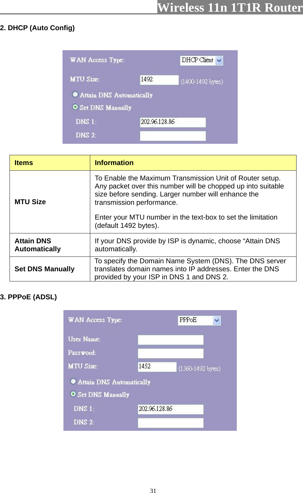                         Wireless 11n 1T1R Router   312. DHCP (Auto Config)  Items  Information MTU Size To Enable the Maximum Transmission Unit of Router setup. Any packet over this number will be chopped up into suitable size before sending. Larger number will enhance the transmission performance.   Enter your MTU number in the text-box to set the limitation (default 1492 bytes). Attain DNS Automatically  If your DNS provide by ISP is dynamic, choose “Attain DNS automatically. Set DNS Manually  To specify the Domain Name System (DNS). The DNS server translates domain names into IP addresses. Enter the DNS provided by your ISP in DNS 1 and DNS 2. 3. PPPoE (ADSL)  