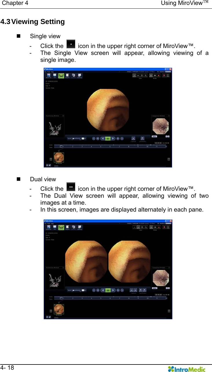   Chapter 4                                            Using MiroView™   4- 18 4.3 Viewing  Setting   Single view - Click the    icon in the upper right corner of MiroView™. -  The Single View screen will appear, allowing viewing of a single image.   Dual view - Click the    icon in the upper right corner of MiroView™. -  The Dual View screen will appear, allowing viewing of two images at a time. -  In this screen, images are displayed alternately in each pane.   