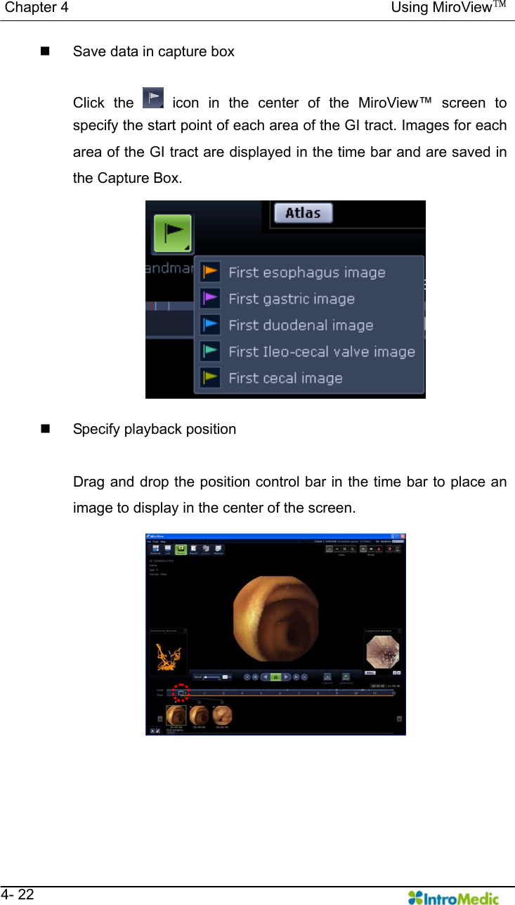   Chapter 4                                            Using MiroView™   4- 22   Save data in capture box  Click the   icon in the center of the MiroView™ screen to specify the start point of each area of the GI tract. Images for each area of the GI tract are displayed in the time bar and are saved in the Capture Box.      Specify playback position  Drag and drop the position control bar in the time bar to place an image to display in the center of the screen.  