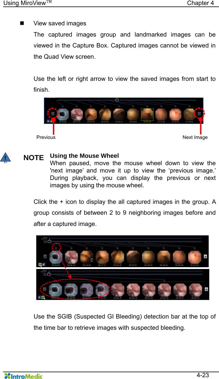   Using MiroView™                                            Chapter 4  4-23   View saved images The captured images group and landmarked images can be viewed in the Capture Box. Captured images cannot be viewed in the Quad View screen.  Use the left or right arrow to view the saved images from start to finish.  NOTE Using the Mouse Wheel When paused, move the mouse wheel down to view the &apos;next image’ and move it up to view the ‘previous image.’ During playback, you can display the previous or next images by using the mouse wheel.  Click the + icon to display the all captured images in the group. A group consists of between 2 to 9 neighboring images before and after a captured image.    Use the SGIB (Suspected GI Bleeding) detection bar at the top of the time bar to retrieve images with suspected bleeding.   Previous Next Image 