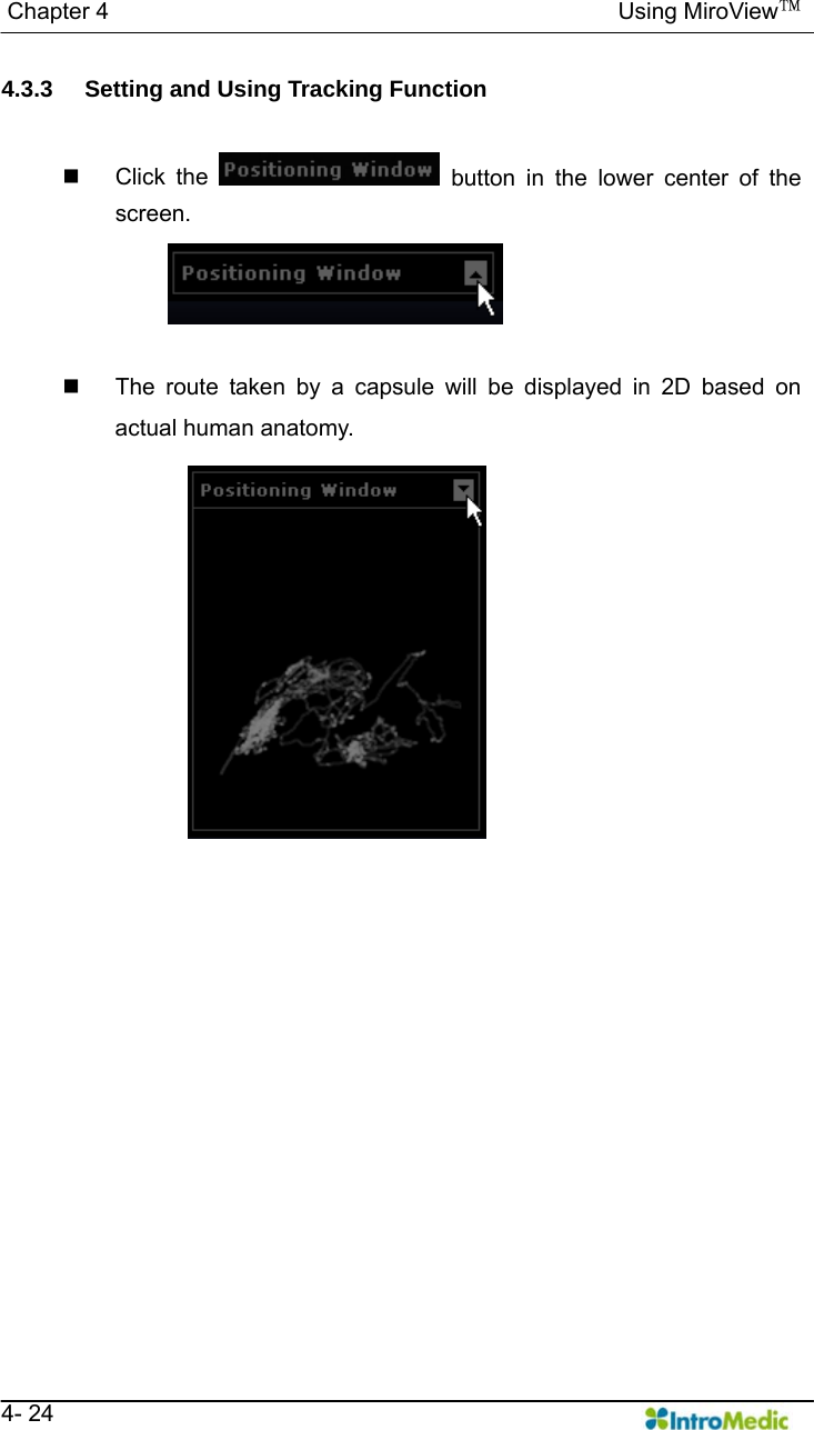   Chapter 4                                            Using MiroView™   4- 24 4.3.3  Setting and Using Tracking Function   Click the   button in the lower center of the screen.    The route taken by a capsule will be displayed in 2D based on actual human anatomy.  