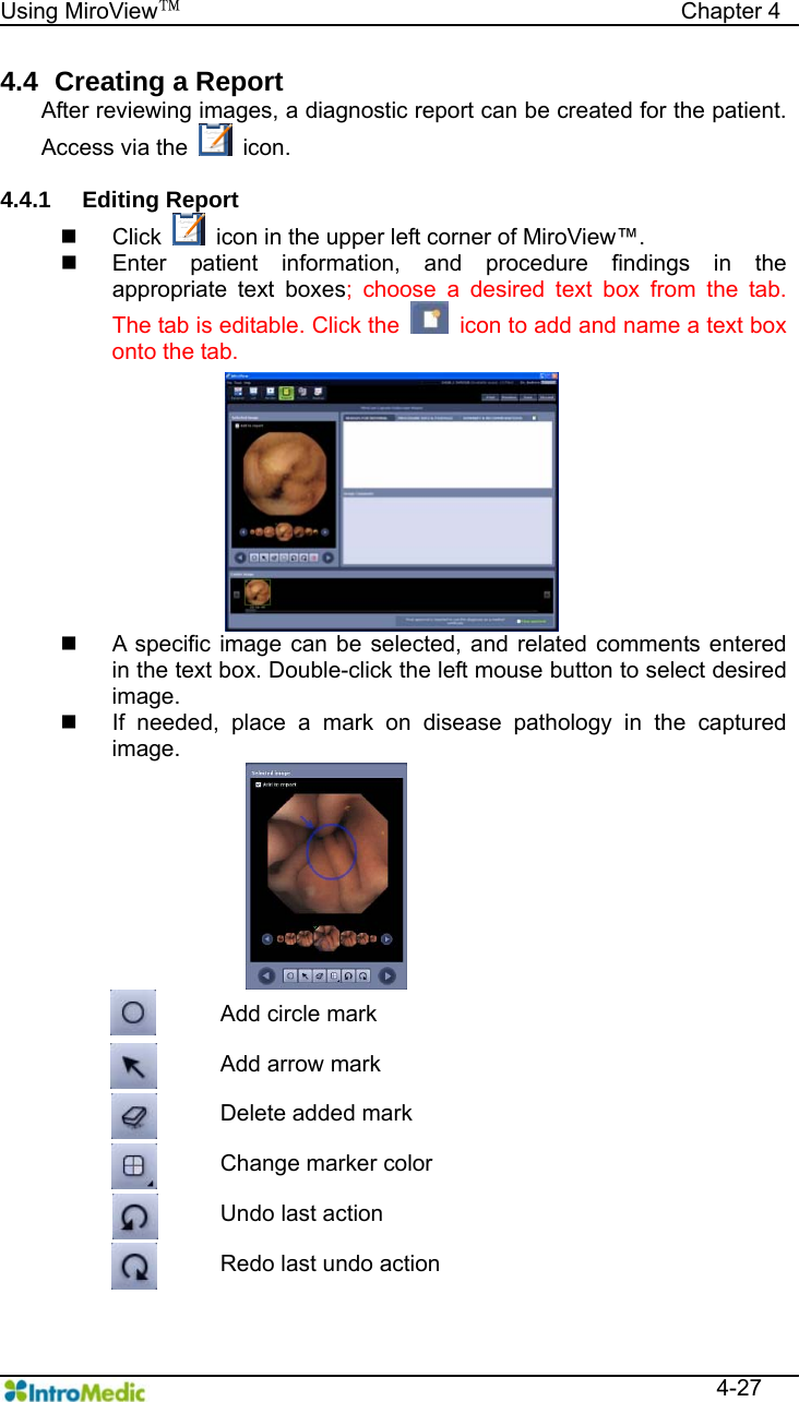   Using MiroView™                                            Chapter 4  4-27 4.4   Creating  a  Report After reviewing images, a diagnostic report can be created for the patient. Access via the   icon.  4.4.1 Editing Report  Click    icon in the upper left corner of MiroView™.   Enter patient information, and procedure findings in the appropriate text boxes; choose a desired text box from the tab. The tab is editable. Click the    icon to add and name a text box onto the tab.   A specific image can be selected, and related comments entered in the text box. Double-click the left mouse button to select desired image.   If needed, place a mark on disease pathology in the captured image.  Add circle mark  Add arrow mark  Delete added mark  Change marker color  Undo last action  Redo last undo action 