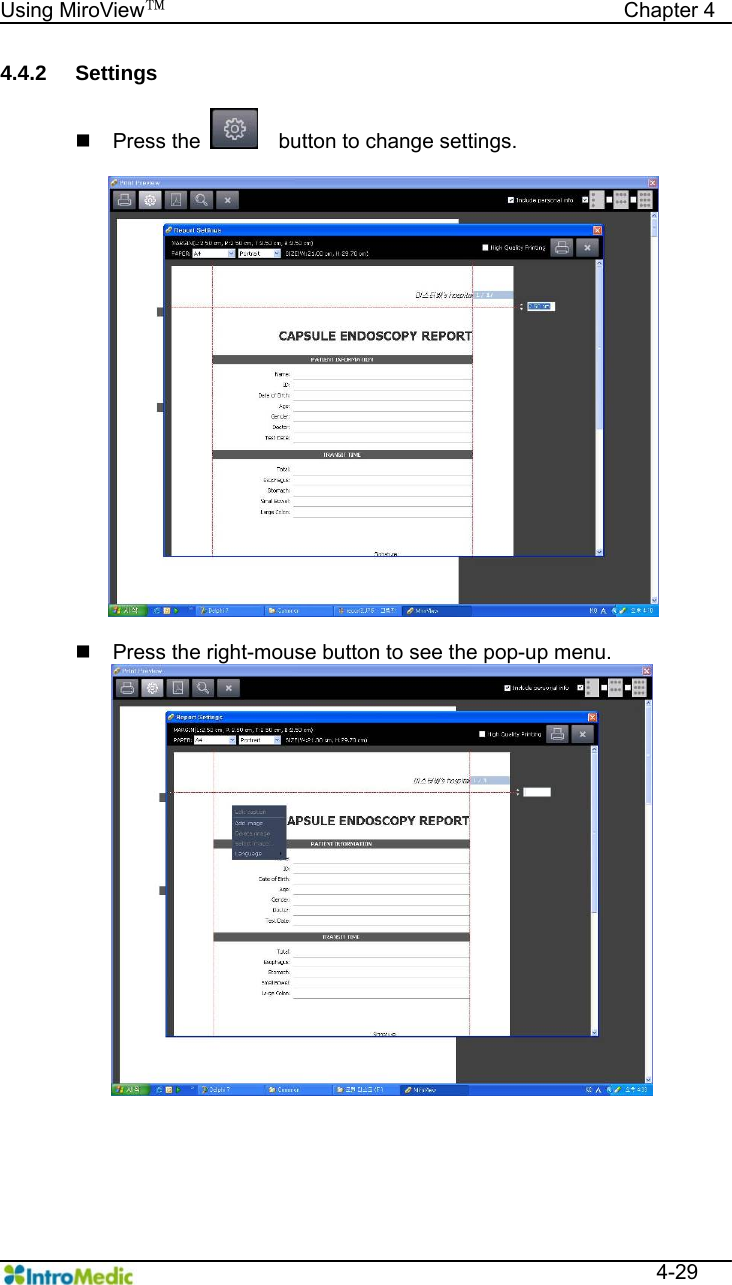   Using MiroView™                                            Chapter 4  4-29 4.4.2 Settings   Press the     button to change settings.    Press the right-mouse button to see the pop-up menu.   