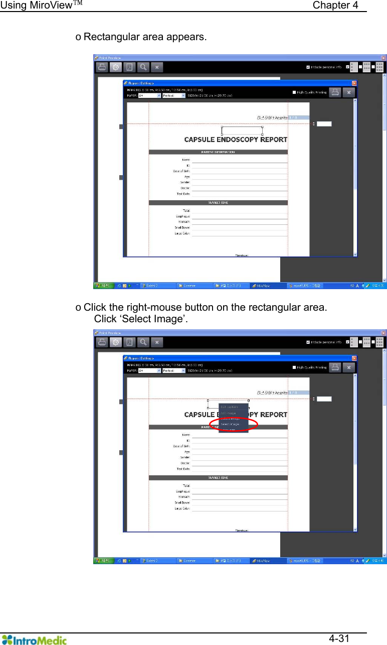   Using MiroView™                                            Chapter 4  4-31 o Rectangular area appears.   o Click the right-mouse button on the rectangular area.   Click ‘Select Image’.   