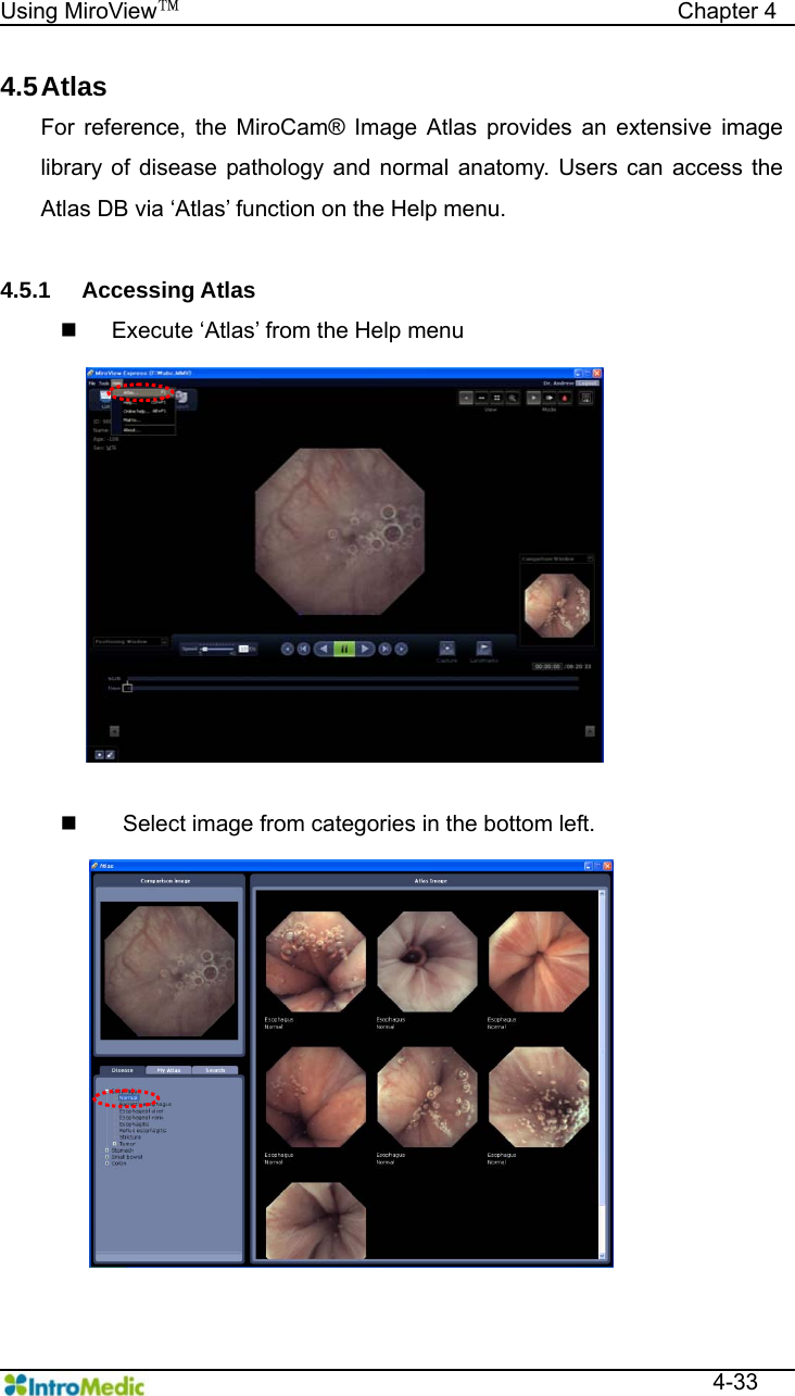   Using MiroView™                                            Chapter 4  4-33 4.5 Atlas For reference, the MiroCam® Image Atlas provides an extensive image library of disease pathology and normal anatomy. Users can access the Atlas DB via ‘Atlas’ function on the Help menu.  4.5.1 Accessing Atlas   Execute ‘Atlas’ from the Help menu      Select image from categories in the bottom left. 