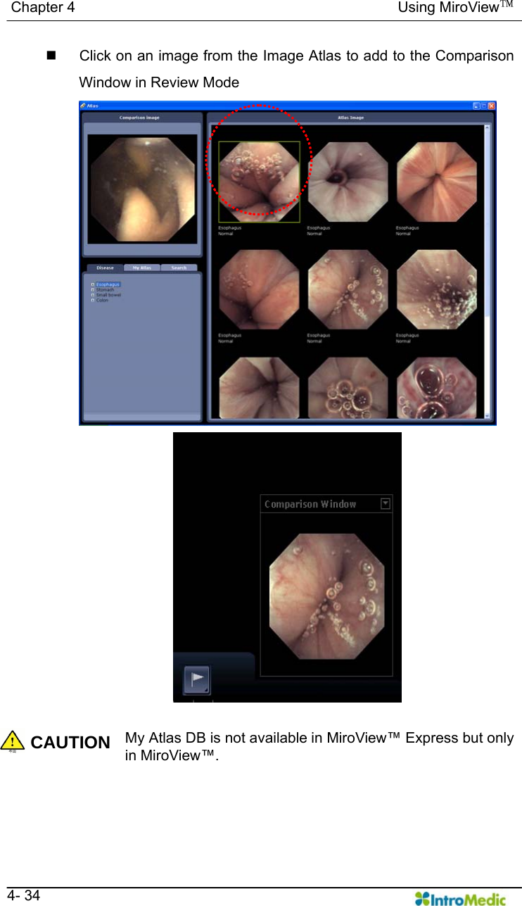   Chapter 4                                            Using MiroView™   4- 34   Click on an image from the Image Atlas to add to the Comparison Window in Review Mode  CAUTION My Atlas DB is not available in MiroView™ Express but only in MiroView™.     