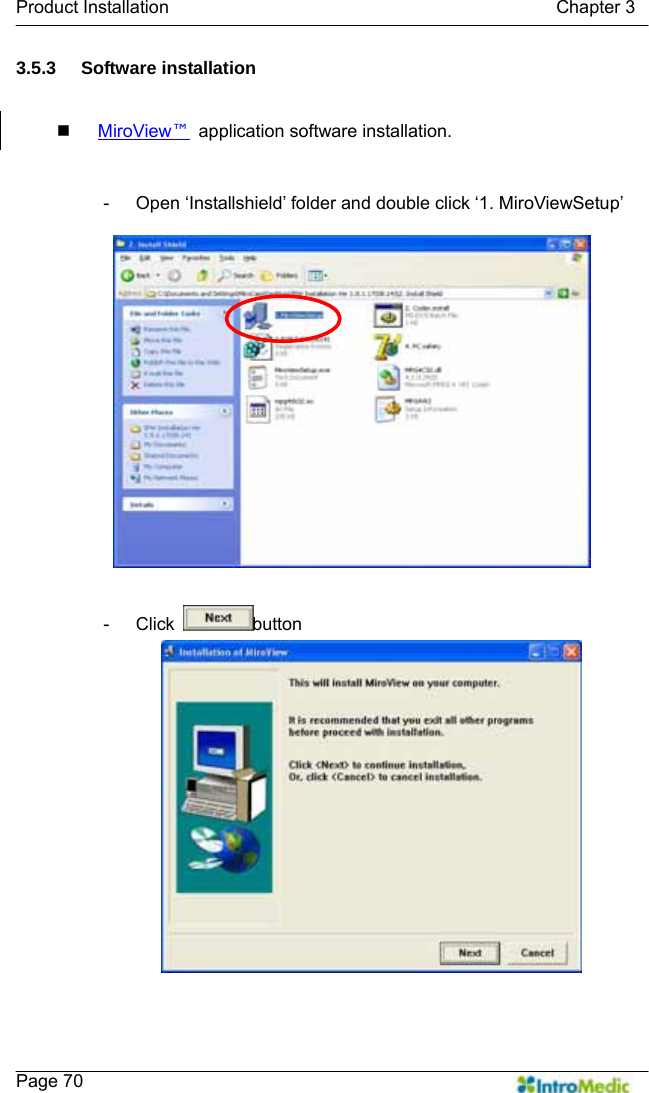   Product Installation                                           Chapter 3    Page 70 3.5.3 Software installation   MiroView™ application software installation.  -  Open ‘Installshield’ folder and double click ‘1. MiroViewSetup’  - Click  button   