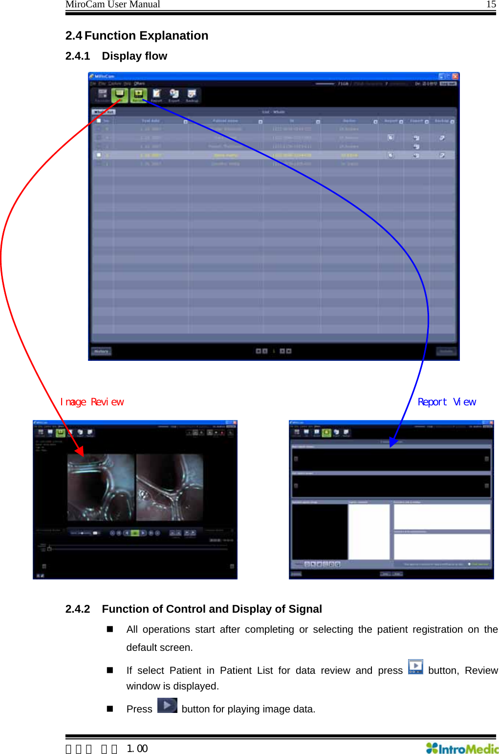 MiroCam User Manual                                                                15 2.4 Function Explanation 2.4.1 Display flow  Report View Image Review 2.4.2  Function of Control and Display of Signal   All operations start after completing or selecting the patient registration on the default screen.   If select Patient in Patient List for data review and press   button, Review window is displayed.    Press    button for playing image data.  한글판 버전 1.00 