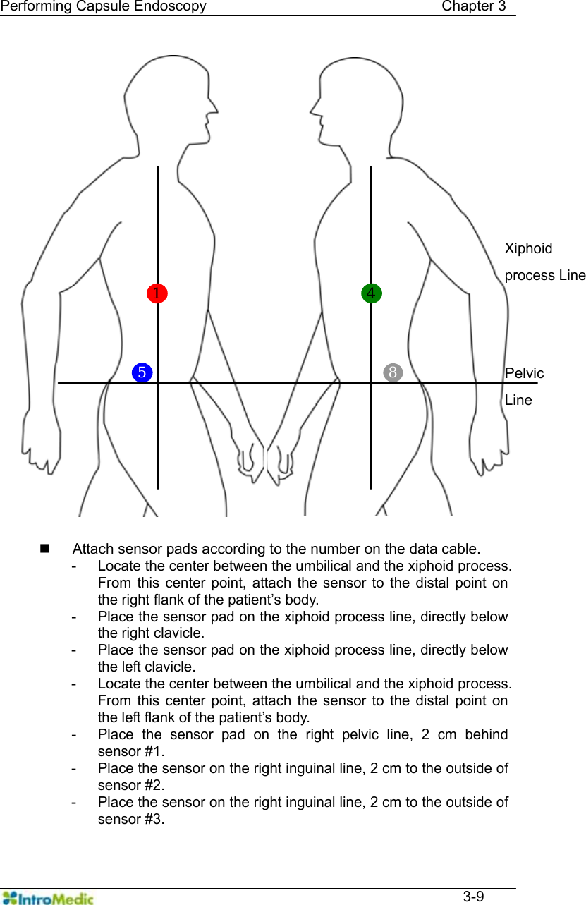   Performing Capsule Endoscopy                                Chapter 3  3-9     3.5.2                    Attach sensor pads according to the number on the data cable. - Locate the center between the umbilical and the xiphoid process. From this center point, attach the sensor to the distal point on the right flank of the patient’s body. - Place the sensor pad on the xiphoid process line, directly below the right clavicle. - Place the sensor pad on the xiphoid process line, directly below the left clavicle. - Locate the center between the umbilical and the xiphoid process. From this center point, attach the sensor to the distal point on the left flank of the patient’s body. - Place the sensor pad on the right pelvic line, 2 cm behind sensor #1. - Place the sensor on the right inguinal line, 2 cm to the outside of sensor #2. - Place the sensor on the right inguinal line, 2 cm to the outside of sensor #3. 5 8Pelvic Line Xiphoid process Line 1  4