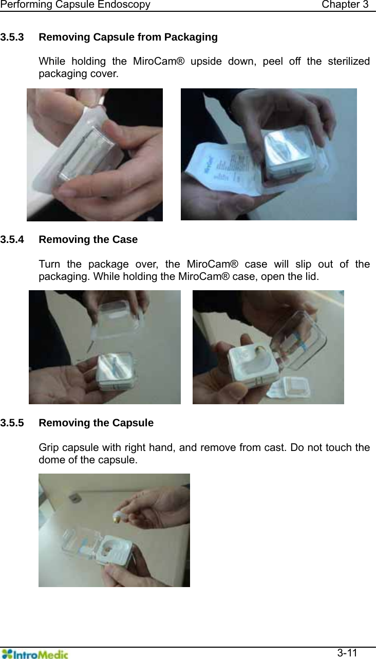   Performing Capsule Endoscopy                                Chapter 3  3-11 3.5.3  Removing Capsule from Packaging    While holding the MiroCam® upside down, peel off the sterilized packaging cover.  3.5.4  Removing the Case  Turn the package over, the MiroCam® case will slip out of the packaging. While holding the MiroCam® case, open the lid.  3.5.5  Removing the Capsule  Grip capsule with right hand, and remove from cast. Do not touch the dome of the capsule.  