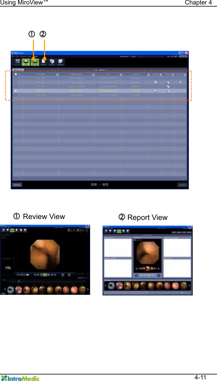   Using MiroView™                                            Chapter 4  4-11  c dc Review View d Report View 