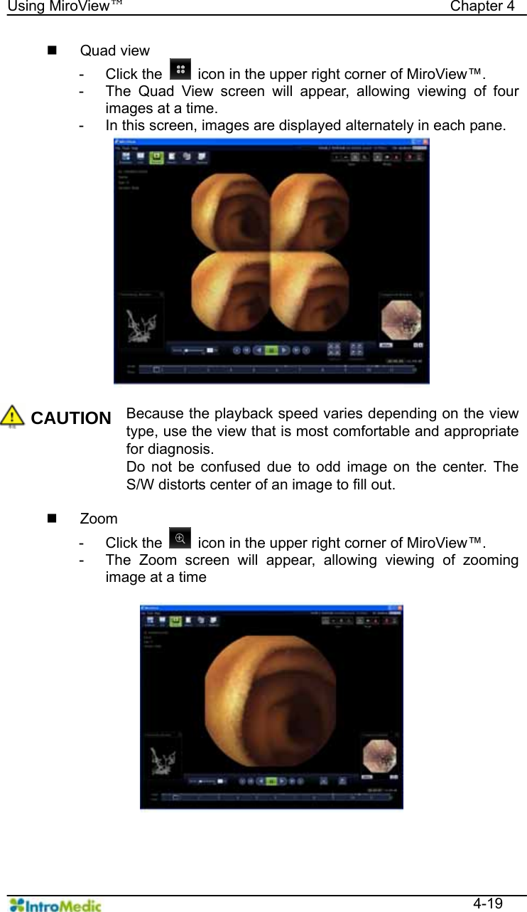   Using MiroView™                                            Chapter 4  4-19  Quad view - Click the    icon in the upper right corner of MiroView™. -  The Quad View screen will appear, allowing viewing of four images at a time. -  In this screen, images are displayed alternately in each pane.  CAUTION Because the playback speed varies depending on the view type, use the view that is most comfortable and appropriate for diagnosis. Do not be confused due to odd image on the center. The S/W distorts center of an image to fill out.   Zoom - Click the    icon in the upper right corner of MiroView™. -  The Zoom screen will appear, allowing viewing of zooming image at a time  