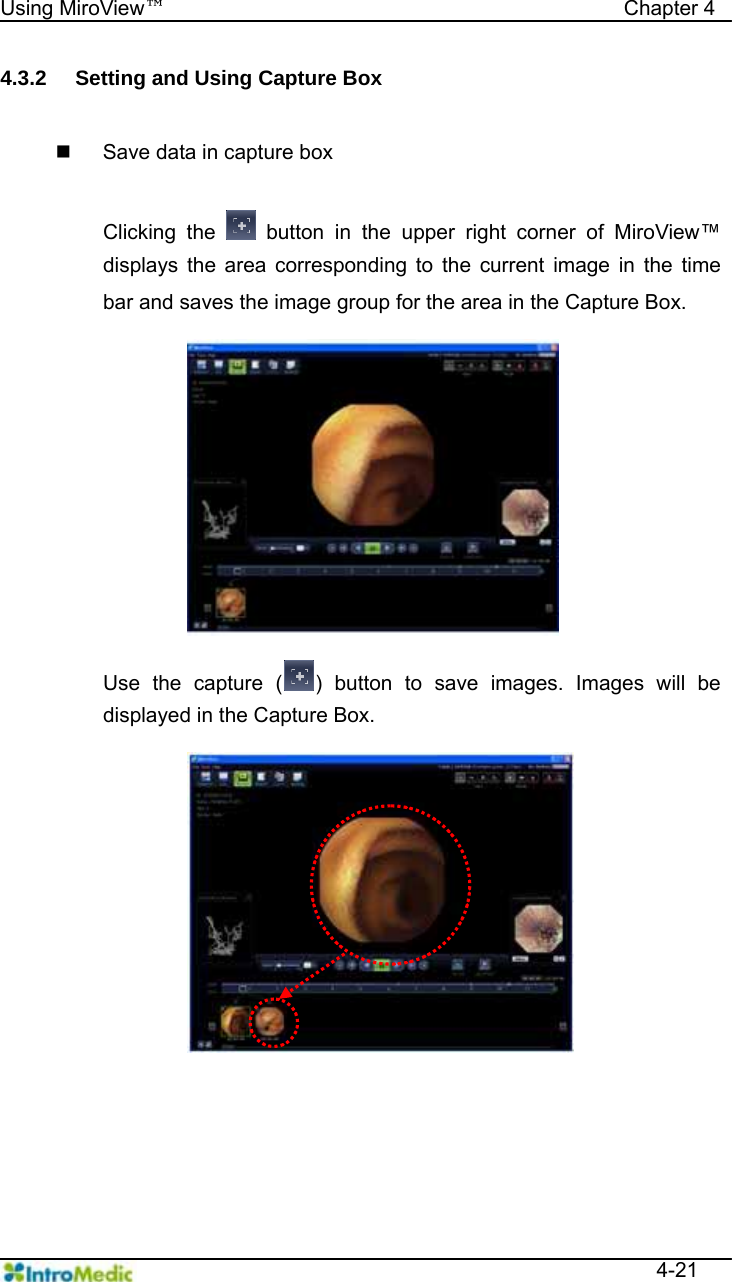   Using MiroView™                                            Chapter 4  4-21 4.3.2  Setting and Using Capture Box    Save data in capture box  Clicking the   button in the upper right corner of MiroView™ displays the area corresponding to the current image in the time bar and saves the image group for the area in the Capture Box.  Use the capture ( ) button to save images. Images will be displayed in the Capture Box.  