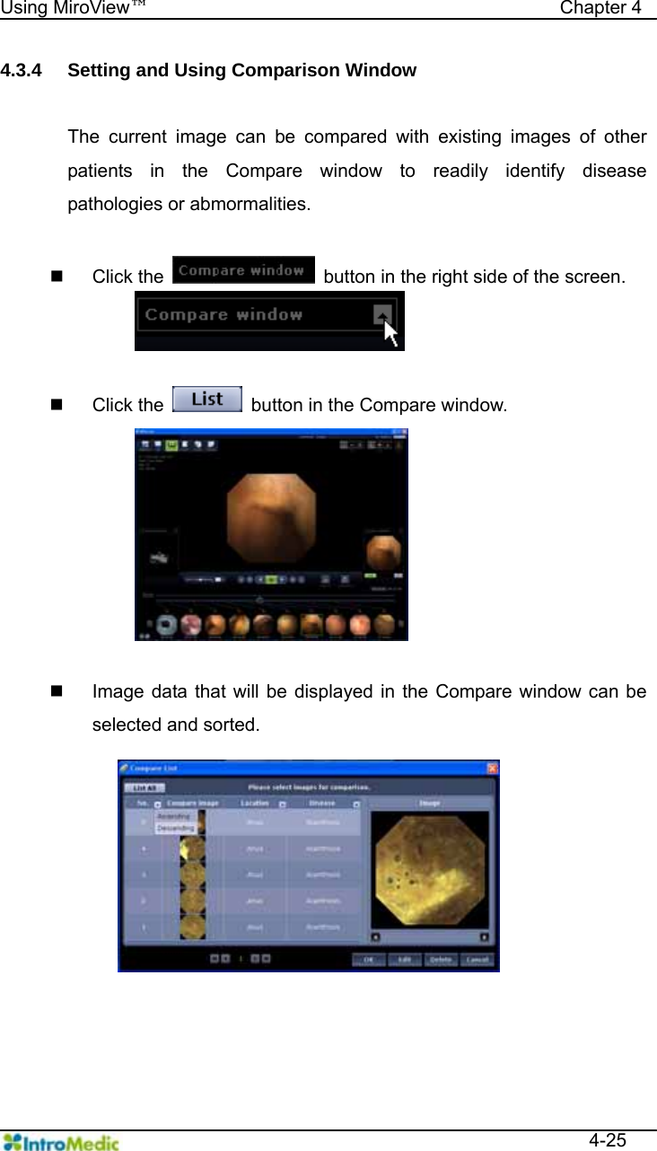   Using MiroView™                                            Chapter 4  4-25 4.3.4  Setting and Using Comparison Window  The current image can be compared with existing images of other patients in the Compare window to readily identify disease pathologies or abmormalities.   Click the    button in the right side of the screen.   Click the    button in the Compare window.    Image data that will be displayed in the Compare window can be selected and sorted.  