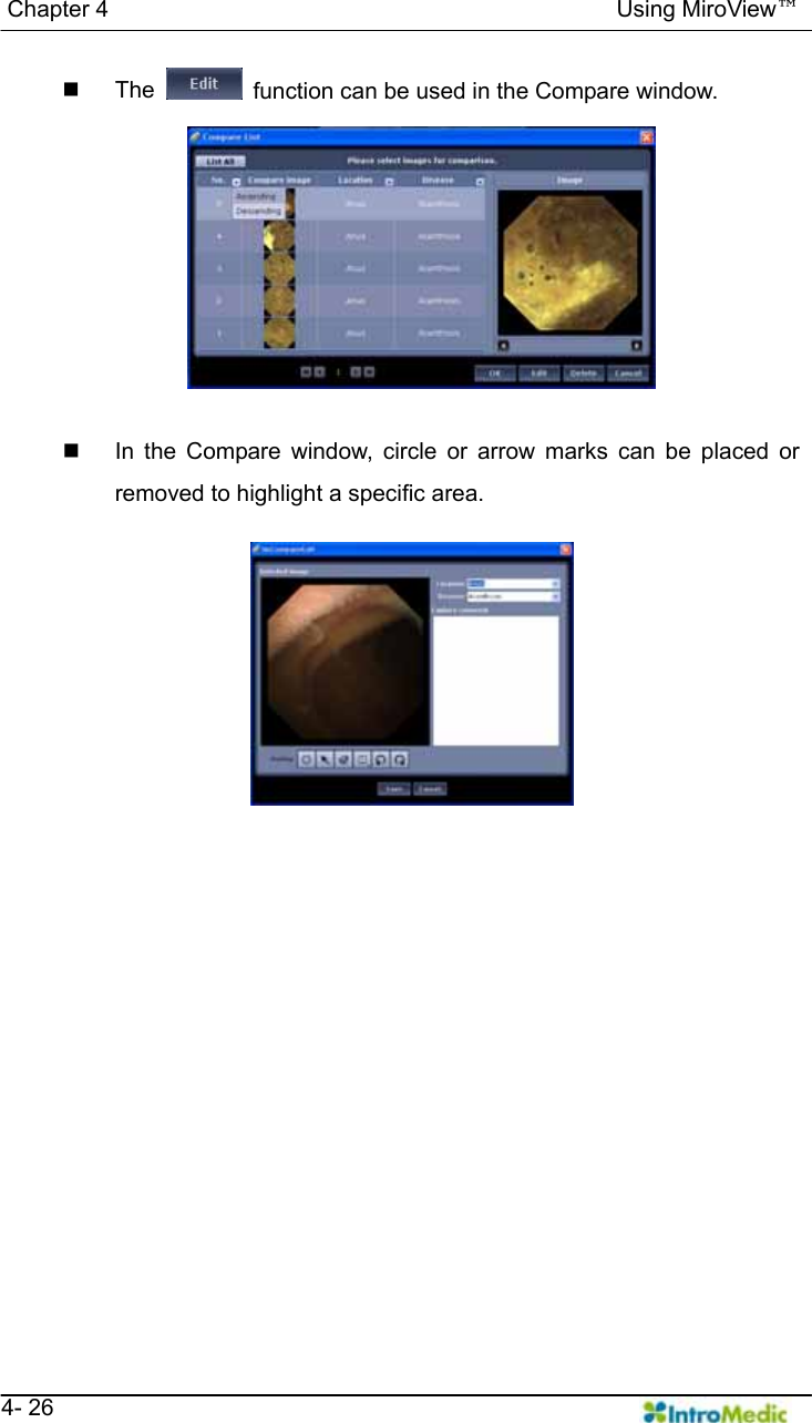   Chapter 4                                            Using MiroView™   4- 26  The    function can be used in the Compare window.    In the Compare window, circle or arrow marks can be placed or removed to highlight a specific area.   