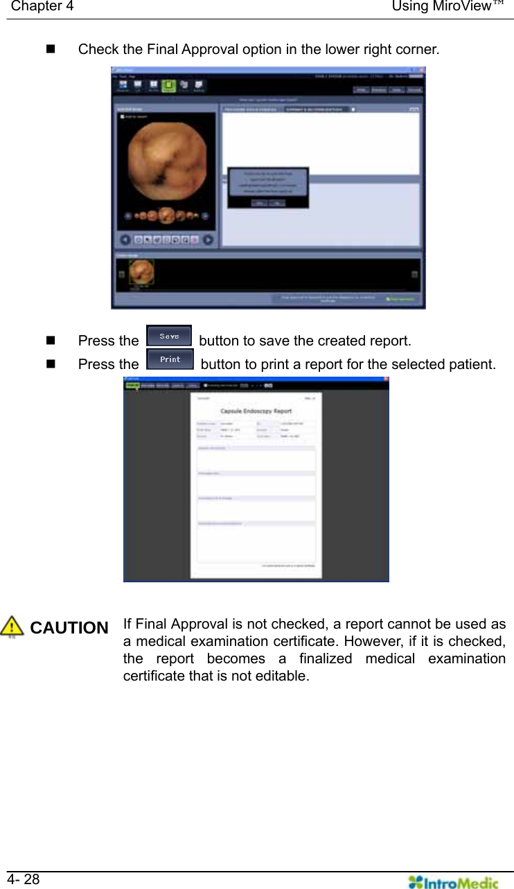   Chapter 4                                            Using MiroView™   4- 28   Check the Final Approval option in the lower right corner.   Press the    button to save the created report.  Press the    button to print a report for the selected patient.   CAUTION If Final Approval is not checked, a report cannot be used as a medical examination certificate. However, if it is checked, the report becomes a finalized medical examination certificate that is not editable.  