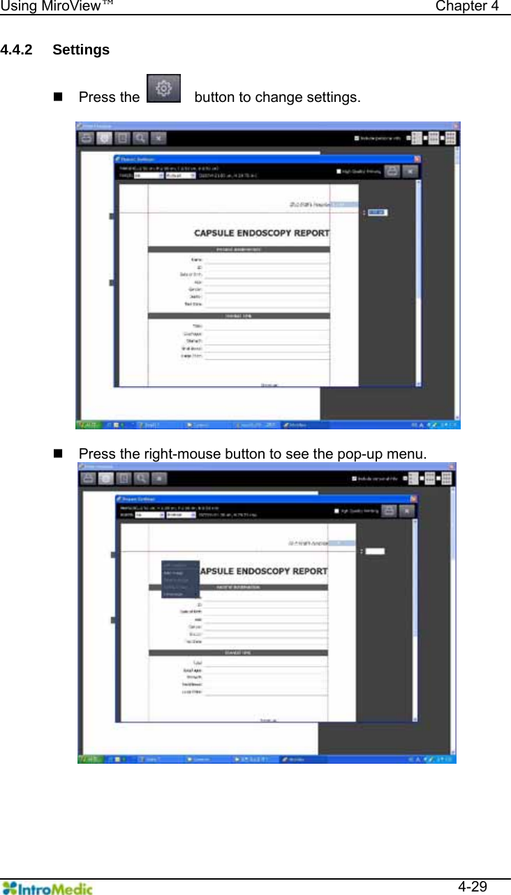   Using MiroView™                                            Chapter 4  4-29 4.4.2 Settings   Press the     button to change settings.    Press the right-mouse button to see the pop-up menu.   