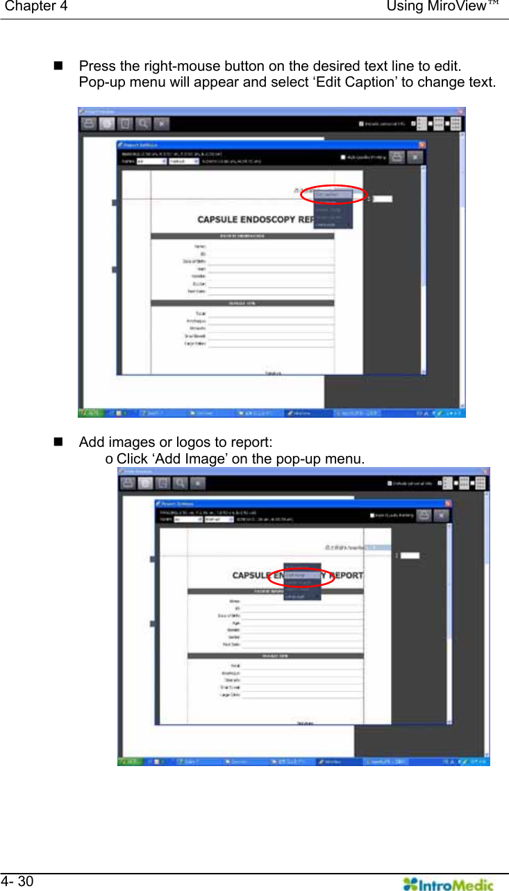   Chapter 4                                            Using MiroView™   4- 30    Press the right-mouse button on the desired text line to edit.   Pop-up menu will appear and select ‘Edit Caption’ to change text.       Add images or logos to report: o Click ‘Add Image’ on the pop-up menu.    