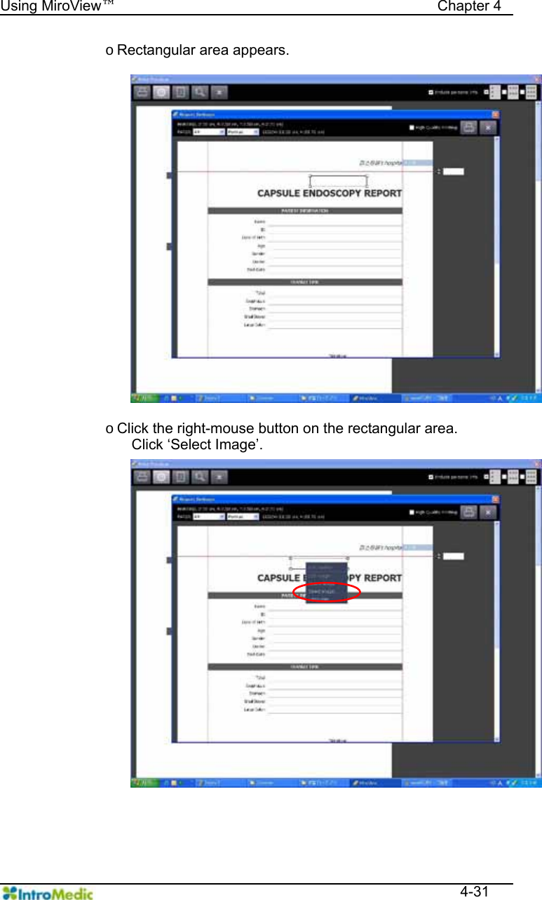   Using MiroView™                                            Chapter 4  4-31 o Rectangular area appears.   o Click the right-mouse button on the rectangular area.   Click ‘Select Image’.   