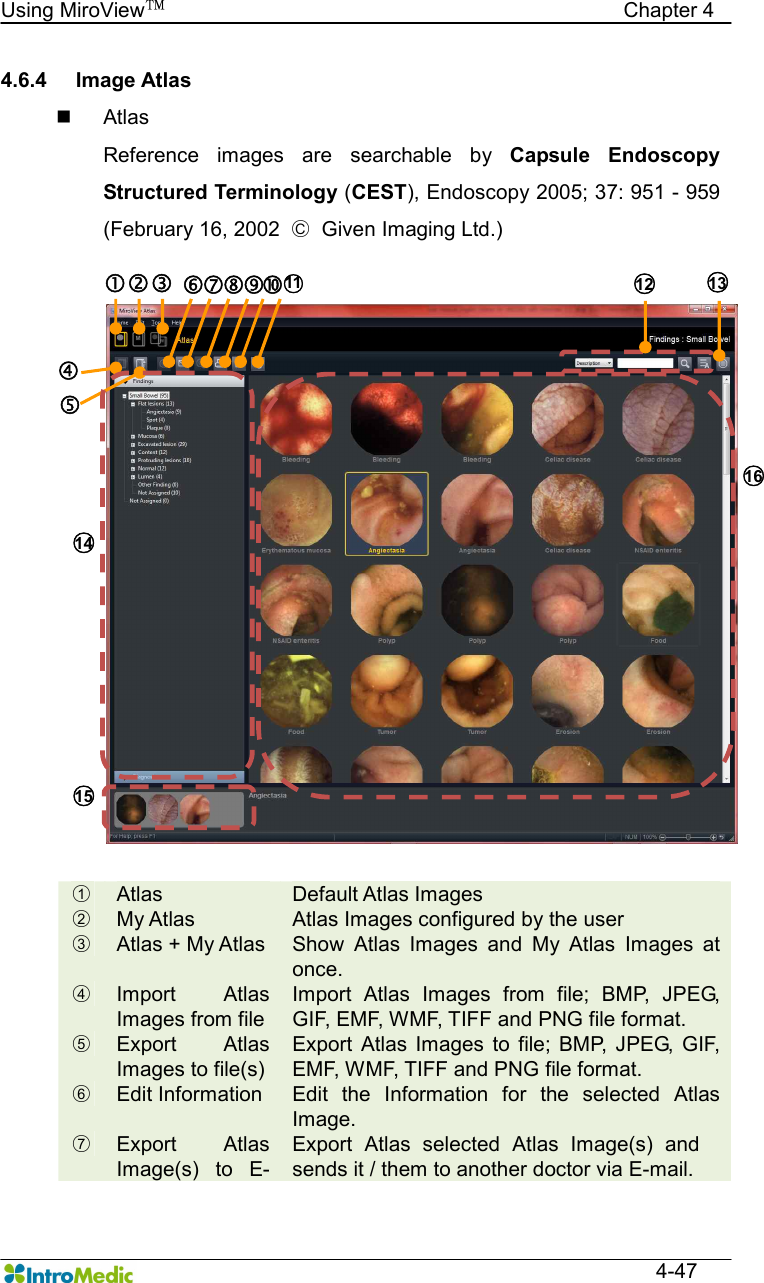   Using MiroView™                                            Chapter 4  4-47 4.6.4  Image Atlas n  Atlas Reference  images  are  searchable  by  Capsule  Endoscopy Structured Terminology (CEST), Endoscopy 2005; 37: 951 - 959 (February 16, 2002  ○C  Given Imaging Ltd.)   ○1  Atlas  Default Atlas Images ○2  My Atlas  Atlas Images configured by the user ○3  Atlas + My Atlas  Show  Atlas  Images  and  My  Atlas  Images  at once. ○4  Import  Atlas Images from file Import  Atlas  Images  from  file;  BMP,  JPEG, GIF, EMF, WMF, TIFF and PNG file format. ○5  Export  Atlas Images to file(s) Export  Atlas  Images  to  file;  BMP,  JPEG,  GIF, EMF, WMF, TIFF and PNG file format. ○6  Edit Information  Edit  the  Information  for  the  selected  Atlas Image. ○7  Export  Atlas Image(s)  to  E-Export  Atlas  selected  Atlas  Image(s)  and sends it / them to another doctor via E-mail.  ‚ ƒ † ‡ ˆ ‰ „ … ○14  ○15  ○12  ○16  ○13  Š ○11  