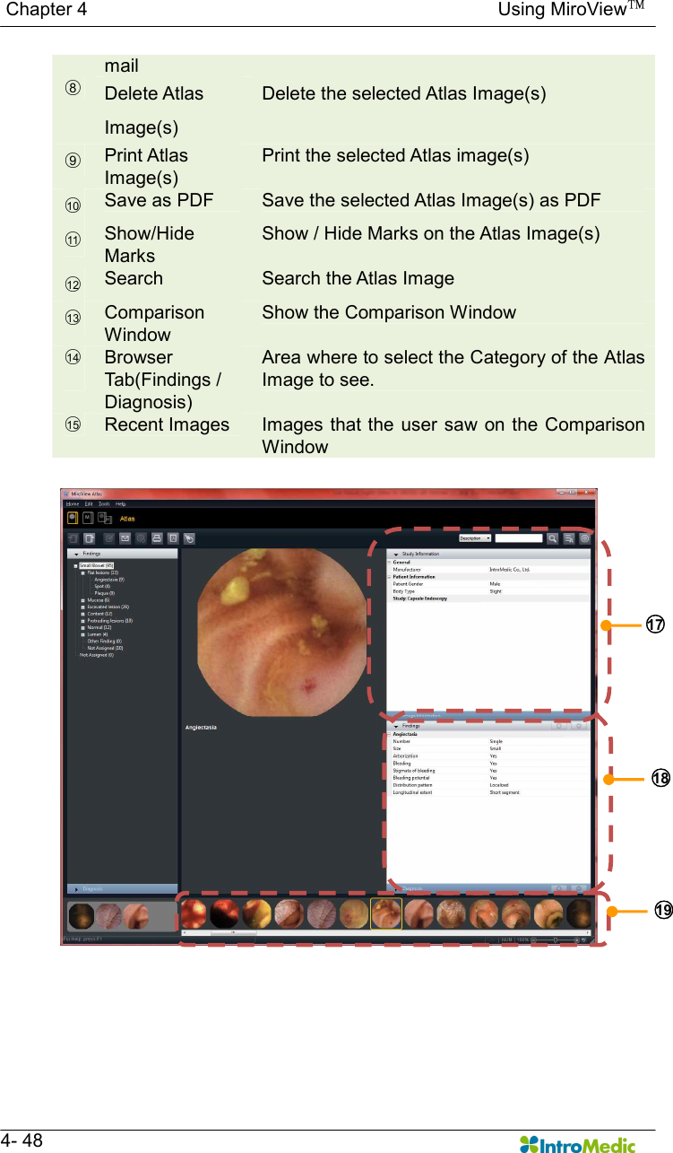   Chapter 4                                                                                        Using MiroView™   4- 48 mail ○8 Delete Atlas   Image(s) Delete the selected Atlas Image(s) ○9 Print Atlas   Image(s) Print the selected Atlas image(s) ○10  Save as PDF  Save the selected Atlas Image(s) as PDF ○11  Show/Hide Marks Show / Hide Marks on the Atlas Image(s) ○12  Search  Search the Atlas Image ○13  Comparison Window Show the Comparison Window ○14   Browser Tab(Findings /   Diagnosis) Area where to select the Category of the Atlas Image to see. ○15   Recent Images  Images  that the user saw on the Comparison Window  ○18  ○19  ○17  