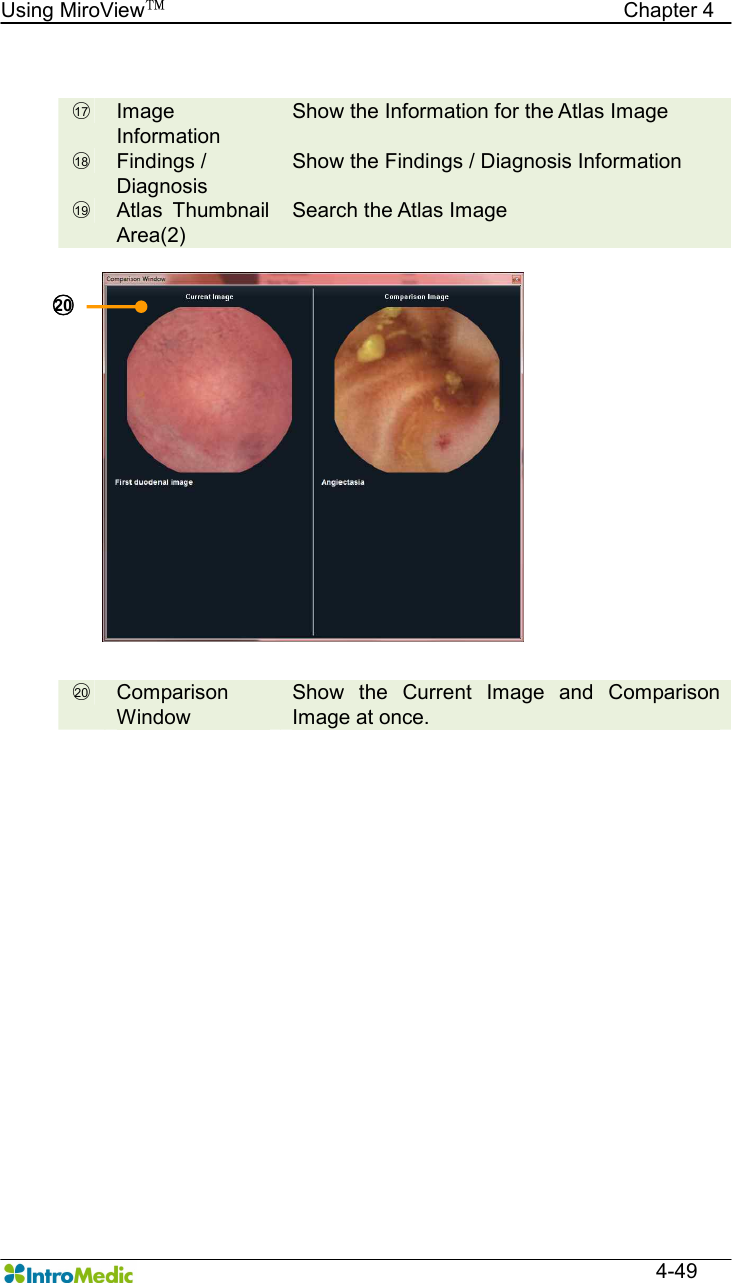   Using MiroView™                                            Chapter 4  4-49  ○17   Image Information Show the Information for the Atlas Image ○18   Findings /   Diagnosis Show the Findings / Diagnosis Information ○19   Atlas  Thumbnail Area(2) Search the Atlas Image  ○20   Comparison Window Show  the  Current  Image  and  Comparison Image at once.  ○20  