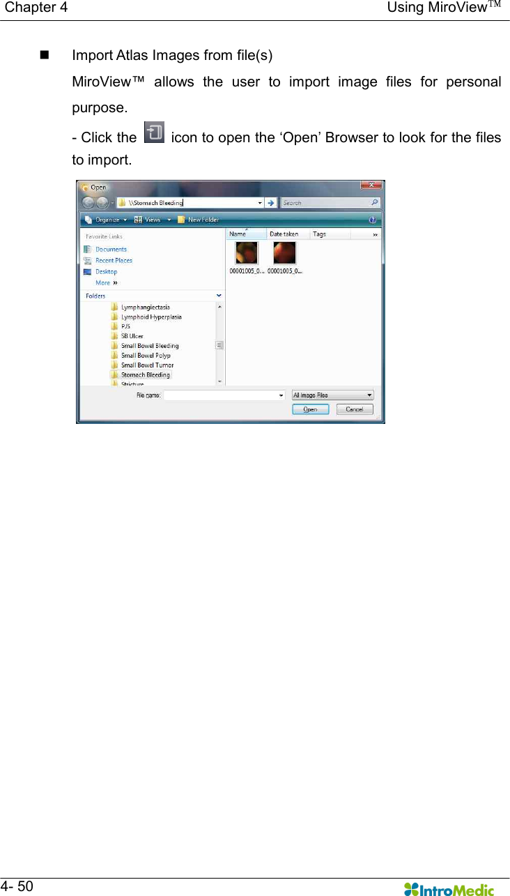   Chapter 4                                                                                        Using MiroView™   4- 50 n  Import Atlas Images from file(s) MiroView™  allows  the  user  to  import  image  files  for  personal purpose. - Click the    icon to open the ‘Open’ Browser to look for the files to import.   