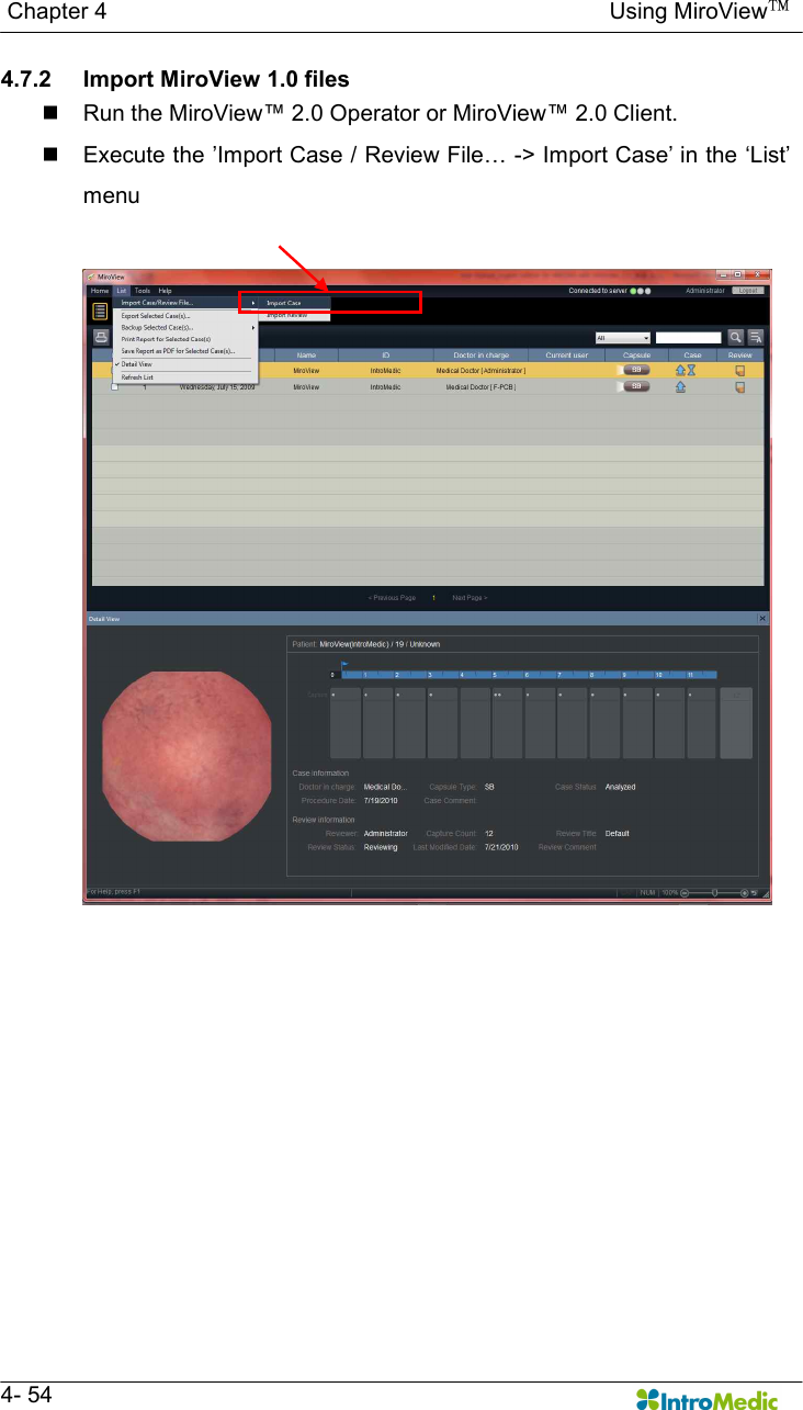  Chapter 4                                                                                        Using MiroView™   4- 54 4.7.2  Import MiroView 1.0 files n  Run the MiroView™ 2.0 Operator or MiroView™ 2.0 Client. n  Execute the ’Import Case / Review File… -&gt; Import Case’ in the ‘List’ menu  