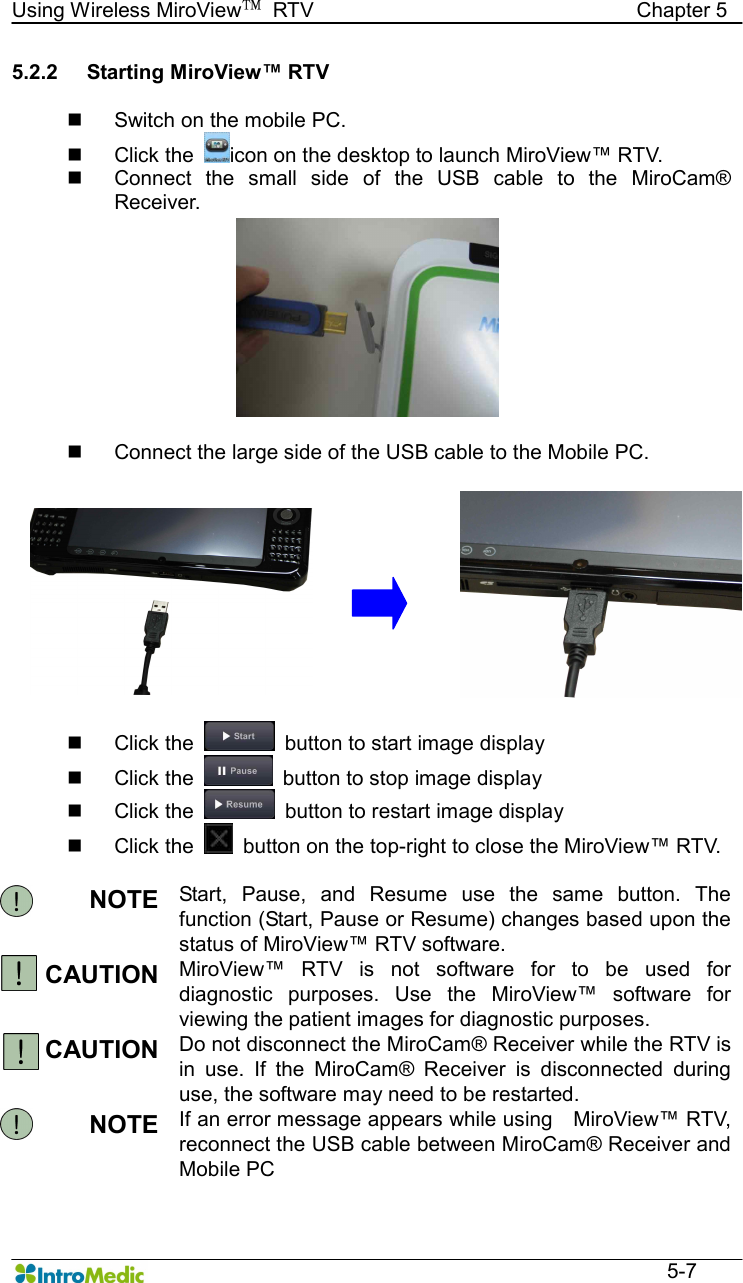   Using Wireless MiroView™  RTV                                                              Chapter 5  5-7 5.2.2  Starting MiroView™ RTV  n  Switch on the mobile PC. n  Click the  icon on the desktop to launch MiroView™ RTV. n  Connect  the  small  side  of  the  USB  cable  to  the  MiroCam® Receiver.  n  Connect the large side of the USB cable to the Mobile PC.   n  Click the    button to start image display n  Click the   button to stop image display n  Click the    button to restart image display n  Click the    button on the top-right to close the MiroView™ RTV.  NOTE  Start,  Pause,  and  Resume  use  the  same  button.  The function (Start, Pause or Resume) changes based upon the status of MiroView™ RTV software. CAUTION  MiroView™  RTV  is  not  software  for  to  be  used  for diagnostic  purposes.  Use  the  MiroView™  software  for viewing the patient images for diagnostic purposes. CAUTION  Do not disconnect the MiroCam® Receiver while the RTV is in  use.  If  the  MiroCam®  Receiver  is  disconnected  during use, the software may need to be restarted. NOTE  If an error message appears while using    MiroView™ RTV, reconnect the USB cable between MiroCam® Receiver and Mobile PC 