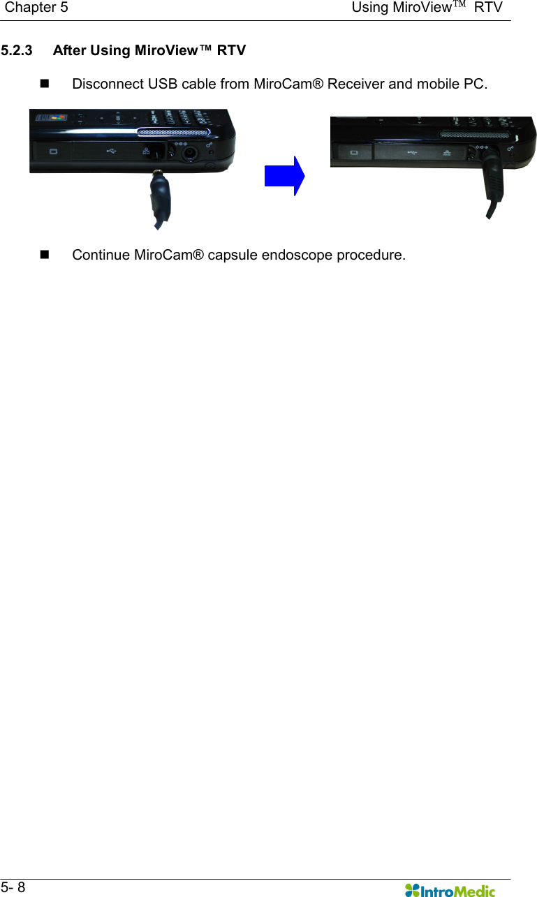   Chapter 5                                                                              Using MiroView™  RTV   5- 8 5.2.3  After Using MiroView™ RTV  n  Disconnect USB cable from MiroCam® Receiver and mobile PC.   n  Continue MiroCam® capsule endoscope procedure.     