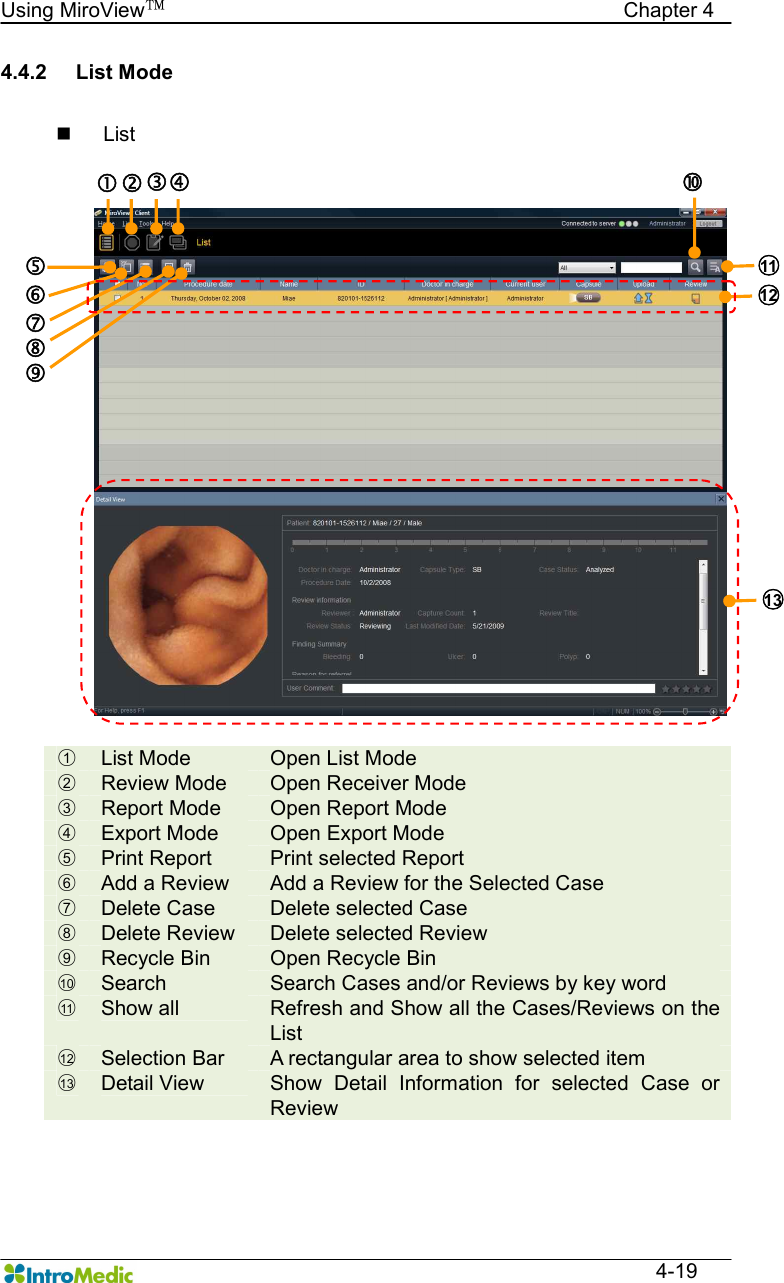   Using MiroView™                                            Chapter 4  4-19 4.4.2  List Mode  n  List                 ○1  List Mode  Open List Mode ○2  Review Mode  Open Receiver Mode ○3  Report Mode  Open Report Mode ○4  Export Mode  Open Export Mode ○5  Print Report  Print selected Report ○6  Add a Review  Add a Review for the Selected Case ○7  Delete Case  Delete selected Case ○8  Delete Review  Delete selected Review ○9  Recycle Bin  Open Recycle Bin ○10   Search  Search Cases and/or Reviews by key word ○11   Show all  Refresh and Show all the Cases/Reviews on the List ○12   Selection Bar  A rectangular area to show selected item ○13   Detail View  Show  Detail  Information  for  selected  Case  or Review    ‚ ƒ „ … † ‡ ˆ ‰ Š ○11  ○12  ○13  