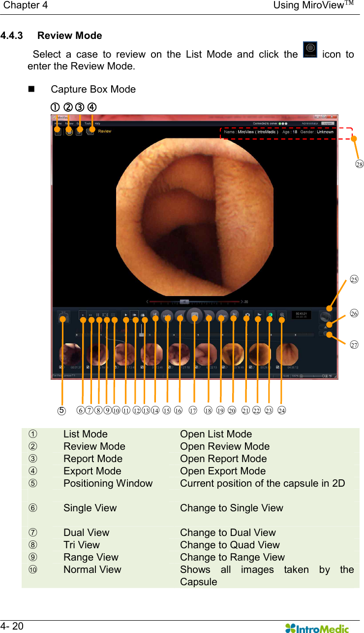  Chapter 4                                                                                        Using MiroView™   4- 20 4.4.3  Review Mode   Select  a  case  to  review  on  the  List  Mode  and  click  the    icon  to enter the Review Mode.  n  Capture Box Mode     ○1  List Mode  Open List Mode ○2  Review Mode  Open Review Mode ○3  Report Mode  Open Report Mode ○4  Export Mode  Open Export Mode ○5  Positioning Window  Current position of the capsule in 2D      ○6  Single View  Change to Single View ○7  Dual View  Change to Dual View ○8  Tri View  Change to Quad View ○9  Range View  Change to Range View ○10   Normal View  Shows  all  images  taken  by  the Capsule  ‚ ƒ „ ○28  ○5 ○6 ○7 ○8 ○9 ○10  ○11  ○12  ○13  ○14  ○15  ○16  ○17  ○18  ○19  ○20  ○21  ○22  ○23  ○24  ○25  ○26  ○27  
