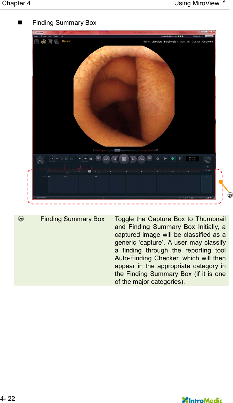   Chapter 4                                                                                        Using MiroView™   4- 22 n  Finding Summary Box   ○28   Finding Summary Box  Toggle  the  Capture  Box to  Thumbnail and  Finding  Summary  Box  Initially,  a captured image will be classified as a generic  ‘capture’.  A  user  may  classify a  finding  through  the  reporting  tool Auto-Finding  Checker,  which will then appear  in  the  appropriate  category  in the Finding  Summary Box  (if it is one of the major categories).   ○28  