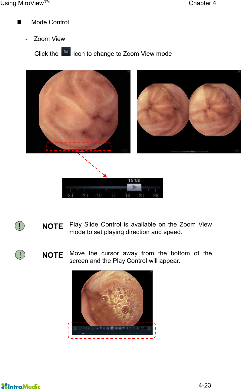   Using MiroView™                                            Chapter 4  4-23 n  Mode Control  -    Zoom View   Click the    icon to change to Zoom View mode        NOTE  Play  Slide  Control  is  available  on  the  Zoom  View mode to set playing direction and speed. NOTE  Move  the  cursor  away  from  the  bottom  of  the screen and the Play Control will appear.   