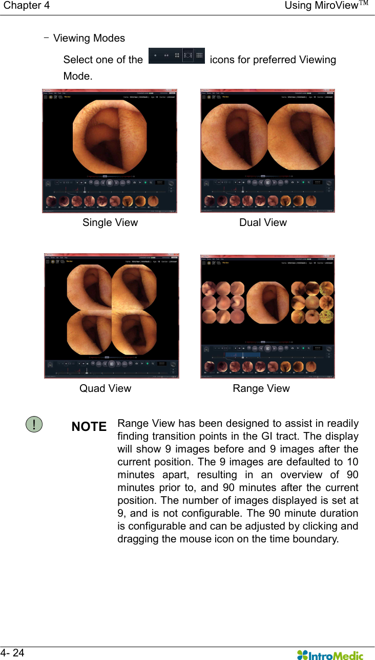   Chapter 4                                                                                        Using MiroView™   4- 24 - Viewing Modes  Select one of the    icons for preferred Viewing         Mode. Single View                                      Dual View  Quad View                                      Range View  NOTE  Range View has been designed to assist in readily finding transition points in the GI tract. The display will show 9  images before and  9 images  after the current position. The 9 images are defaulted to 10 minutes  apart,  resulting  in  an  overview  of  90 minutes  prior  to,  and  90  minutes  after  the  current position. The number of images displayed is set at 9, and is not configurable. The 90 minute duration is configurable and can be adjusted by clicking and dragging the mouse icon on the time boundary. 