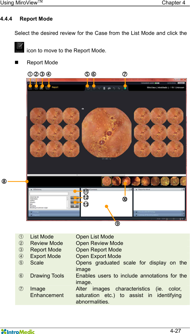   Using MiroView™                                            Chapter 4  4-27 4.4.4  Report Mode  Select the desired review for the Case from the List Mode and click the   icon to move to the Report Mode. n  Report Mode    ○1  List Mode  Open List Mode ○2  Review Mode  Open Review Mode ○3  Report Mode  Open Report Mode ○4  Export Mode  Open Export Mode ○5  Scale  Opens  graduated  scale  for  display  on  the image ○6  Drawing Tools  Enables  users  to  include  annotations  for  the image. ○7  Image Enhancement Alter  images  characteristics  (ie.  color, saturation  etc.)  to  assist  in  identifying abnormalities.  ‚ ƒ „ … † ‡ ˆ Š ○11  ○12  ○13  ‰ 