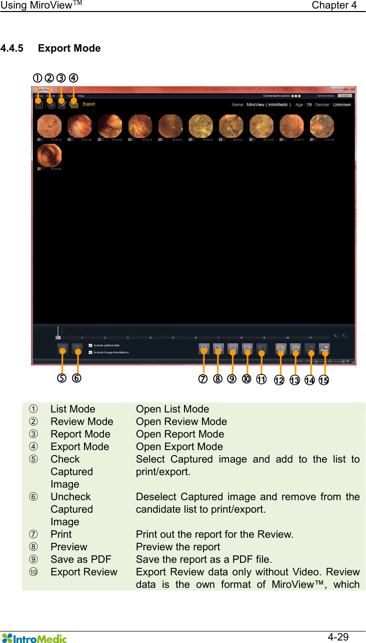   Using MiroView™                                            Chapter 4  4-29  4.4.5  Export Mode    ○1  List Mode  Open List Mode ○2  Review Mode  Open Review Mode ○3  Report Mode  Open Report Mode ○4  Export Mode  Open Export Mode ○5  Check Captured Image Select  Captured  image  and  add  to  the  list  to print/export. ○6  Uncheck Captured Image Deselect  Captured  image  and  remove  from  the candidate list to print/export. ○7  Print  Print out the report for the Review. ○8  Preview  Preview the report ○9  Save as PDF  Save the report as a PDF file. ○10   Export Review  Export  Review  data  only  without  Video.  Review data  is  the  own  format  of  MiroView™,  which  ‚ ƒ „ ○14  … † ‡ ˆ ‰ Š ○11  ○12  ○13  ○15  