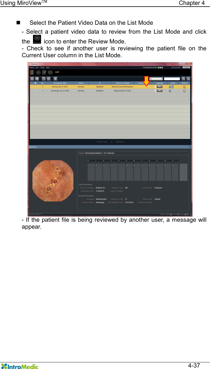   Using MiroView™                                            Chapter 4  4-37 n  Select the Patient Video Data on the List Mode -  Select  a patient video  data to  review  from  the List  Mode and click the    icon to enter the Review Mode. -  Check  to  see  if  another  user  is  reviewing  the  patient  file  on  the Current User column in the List Mode. - If the patient file is being reviewed by another user, a message will appear.  