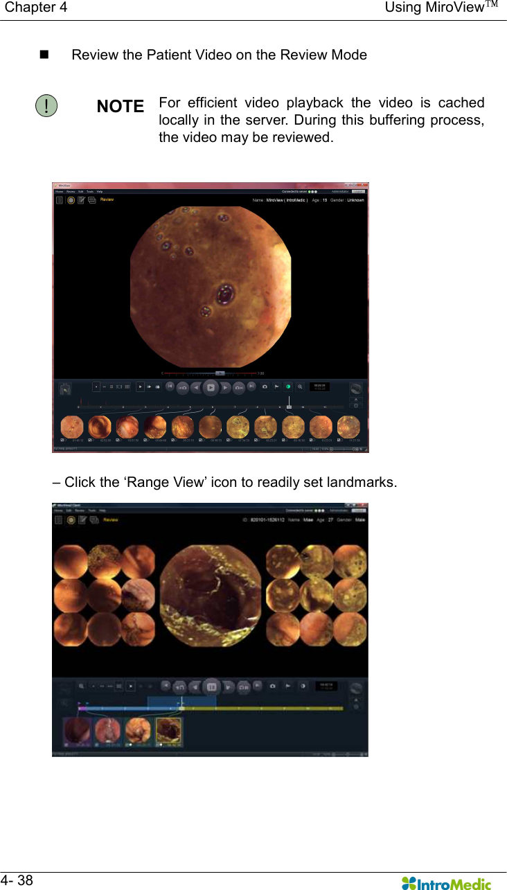   Chapter 4                                                                                        Using MiroView™   4- 38 n  Review the Patient Video on the Review Mode  NOTE  For  efficient  video  playback  the  video  is  cached locally in the server. During this buffering process, the video may be reviewed.   – Click the ‘Range View’ icon to readily set landmarks. 