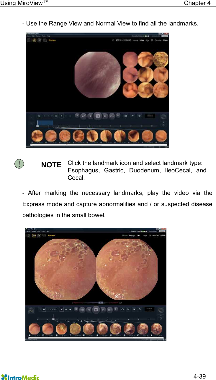   Using MiroView™                                            Chapter 4  4-39 - Use the Range View and Normal View to find all the landmarks.  NOTE  Click the landmark icon and select landmark type: Esophagus,  Gastric,  Duodenum,  IleoCecal,  and Cecal. -  After  marking  the  necessary  landmarks,  play  the  video  via  the Express mode and capture abnormalities and / or suspected disease pathologies in the small bowel. 