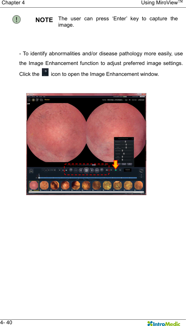   Chapter 4                                                                                        Using MiroView™   4- 40 NOTE  The  user  can  press  ‘Enter’  key  to  capture  the image.  - To identify abnormalities and/or disease pathology  more easily, use the Image Enhancement  function  to adjust preferred  image settings. Click the    icon to open the Image Enhancement window.    