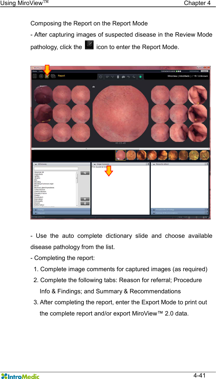   Using MiroView™                                            Chapter 4  4-41 Composing the Report on the Report Mode - After capturing images of suspected disease in the Review Mode pathology, click the    icon to enter the Report Mode.   -  Use  the  auto  complete  dictionary  slide  and  choose  available disease pathology from the list. - Completing the report:   1. Complete image comments for captured images (as required)   2. Complete the following tabs: Reason for referral; Procedure         Info &amp; Findings; and Summary &amp; Recommendations   3. After completing the report, enter the Export Mode to print out             the complete report and/or export MiroView™ 2.0 data. 