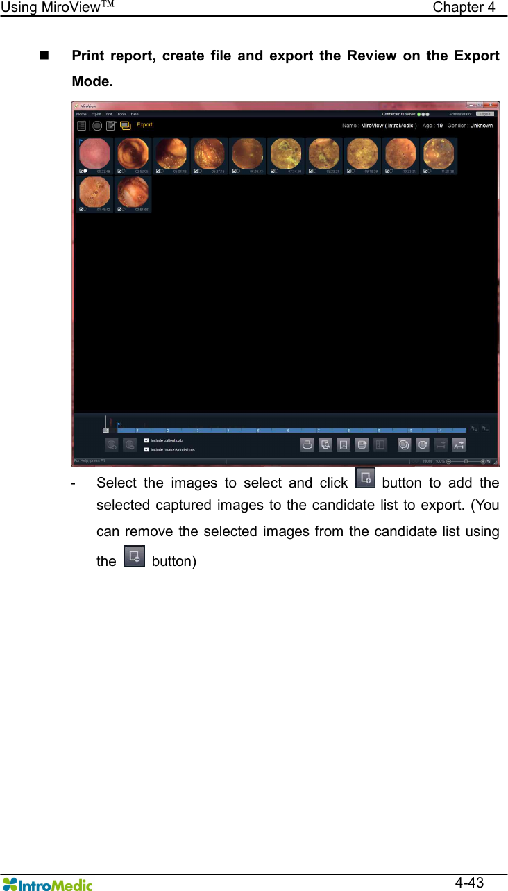   Using MiroView™                                            Chapter 4  4-43 n Print  report,  create  file  and  export  the  Review  on  the  Export Mode. -  Select  the  images  to  select  and  click    button  to  add  the selected captured images  to the candidate list  to  export. (You can remove the selected  images from the candidate list using the    button) 