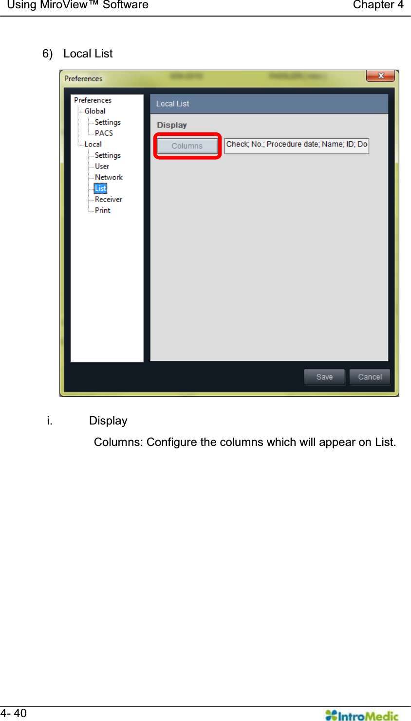   Using MiroView Software                                   Chapter 4   4- 40  6) Local List  i. Display Columns: Configure the columns which will appear on List. 