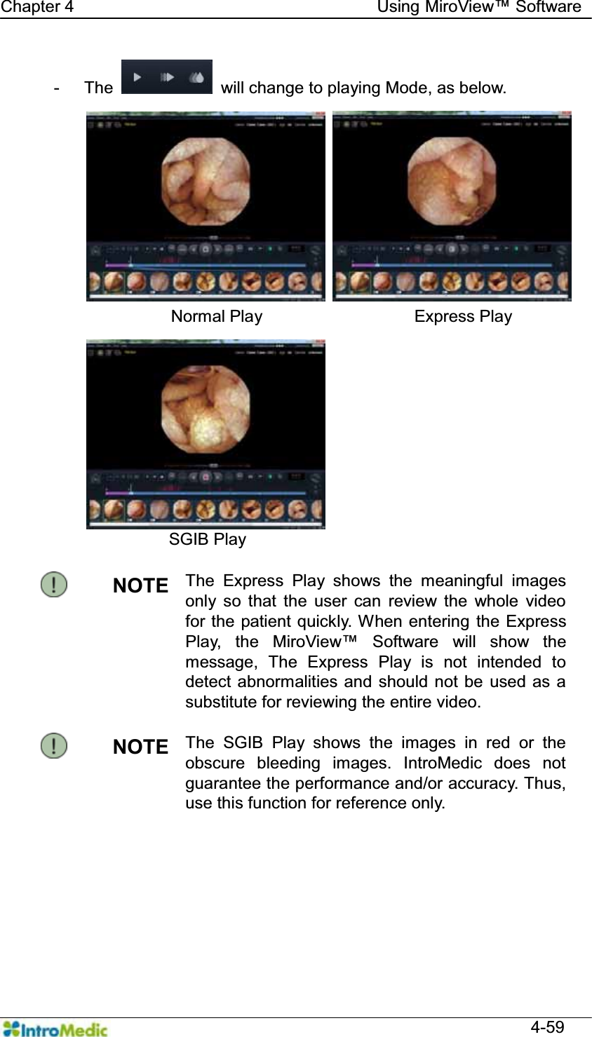   Chapter 4                                    Using 0LUR9LHZ Software  4-59 - The    will change to playing Mode, as below.              Normal Play                  Express Play SGIB Play  NOTE  The Express Play shows the meaningful images only so that the user can review the whole video for the patient quickly. When entering the Express Play, the 0LUR9LHZ Software will show the message, The Express Play is not intended to detect abnormalities and should not be used as a substitute for reviewing the entire video.  NOTE  The SGIB Play shows the images in red or the obscure bleeding images. IntroMedic does not guarantee the performance and/or accuracy. Thus, use this function for reference only.  