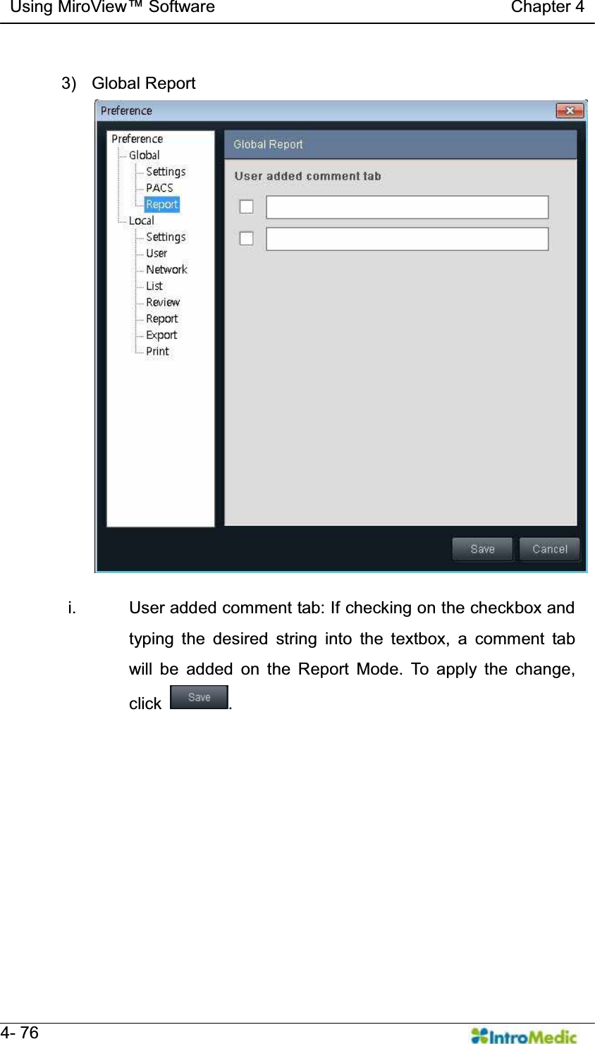   Using MiroView Software                                   Chapter 4   4- 76  3) Global Report  i.  User added comment tab: If checking on the checkbox and typing the desired string into the textbox, a comment tab will be added on the Report Mode. To apply the change, click  . 