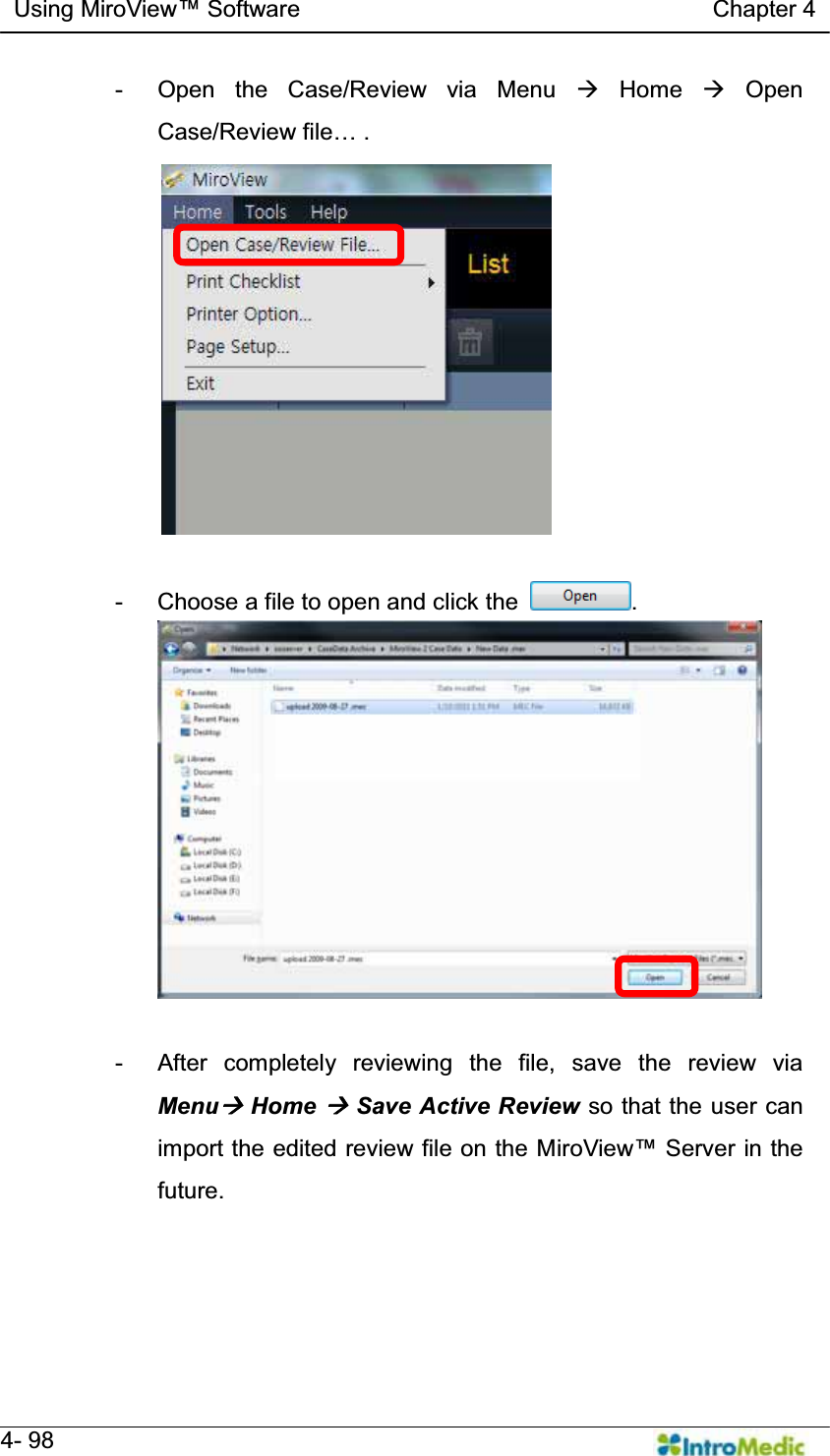   Using MiroView Software                                   Chapter 4   4- 98 -  Open the Case/Review via Menu Æ Home Æ Open &amp;DVH5HYLHZILOH«.  -  Choose a file to open and click the  .  -  After completely reviewing the file, save the review via MenuÆ Home Æ Save Active Review so that the user can import the edited review file on the MLUR9LHZ6HUYHULQWKHfuture. 