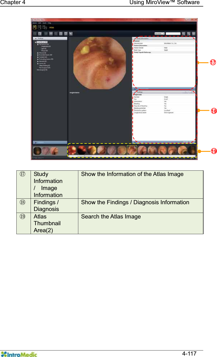   Chapter 4                                    Using 0LUR9LHZ Software  4-117  Ԩ  Study Information  /  Image  Information Show the Information of the Atlas Image ԩ Findings /   Diagnosis Show the Findings / Diagnosis Information Ԫ Atlas Thumbnail Area(2) Search the Atlas Image  ̺18  ̺19  ̺17  